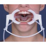 RETRACTOR DE MEJILLAS NOLA CON EYECTOR DE SALIVA